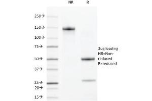 SDS-PAGE Analysis Purified VEGFR2 Rat Monoclonal Antibody (DC101). (VEGFR2/CD309 抗体)