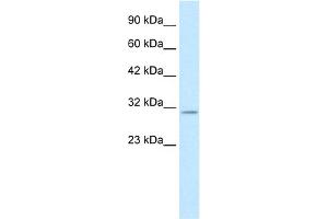 WB Suggested Anti-KCNIP4 Antibody Titration:  0. (KCNIP4 抗体  (N-Term))