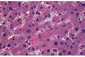 Human Liver: Formalin-Fixed, Paraffin-Embedded (FFPE) (ORM1 抗体  (AA 18-202))