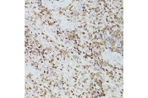 Immunohistochemistry of paraffin-embedded rat spleen using G antibody (ABIN6133721, ABIN6140975, ABIN6140976 and ABIN6217864) at dilution of 1:150 (40x lens). (GATA4 抗体  (AA 50-150))