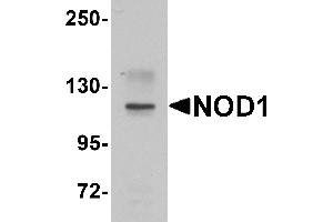 Western blot analysis of NOD1 in EL4 cell lysate with NOD1 antibody at 1 µg/mL. (NOD1 抗体  (C-Term))