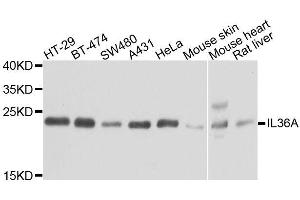 Western blot analysis of extracts of various cell lines, using IL36A antibody. (IL36A/IL1F6 抗体  (AA 1-158))