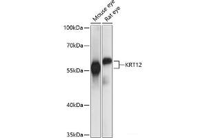 Western blot analysis of extracts of various cell lines using KRT12 Polyclonal Antibody at dilution of 1:1000. (KRT12 抗体)