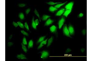 Immunofluorescence of monoclonal antibody to WDR5 on HeLa cell. (WDR5 抗体  (AA 16-120))