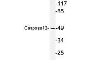 Western blot analysis of Caspase12 antibody in extracts from HUVEC cells. (Caspase 12 抗体)