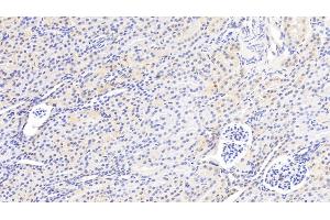 Detection of GSTM2 in Human Kidney Tissue using Polyclonal Antibody to Glutathione S Transferase Mu 2 (GSTM2) (GSTM2 抗体  (AA 3-218))