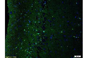 Immunofluorescence (IF) image for anti-Glutamate Receptor, Ionotropic, N-Methyl D-Aspartate 2B (GRIN2B) (AA 451-550) antibody (ABIN726485)