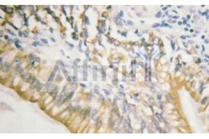 Phospho-c-Met (Tyr1003) Antibody for IHC in human testis (c-MET 抗体  (pTyr1003))