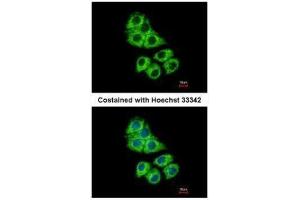 Immunofluorescence (IF) image for anti-Coronin, Actin Binding Protein, 1A (CORO1A) (C-Term) antibody (ABIN2856372)