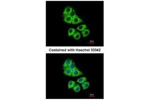 ICC/IF Image Immunofluorescence analysis of methanol-fixed Hep G2, using Coronin 1A, antibody at 1:500 dilution. (Coronin 1a 抗体  (C-Term))
