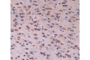 Immunohistochemistry (IHC) image for anti-Tubulin, epsilon 1 (TUBE1) (AA 236-473) antibody (ABIN1860889)