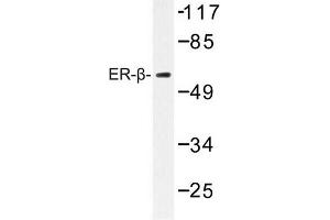 Image no. 1 for anti-Estrogen Receptor 2 (ESR2) antibody (ABIN272305) (ESR2 抗体)