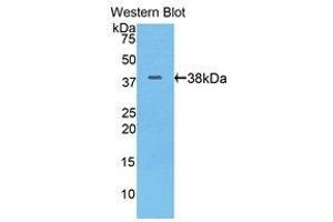 Western Blotting (WB) image for anti-Keratin 17 (KRT17) (AA 84-392) antibody (ABIN1175075) (KRT17 抗体  (AA 84-392))
