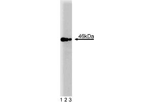 Western blot analysis of IAK1 on a Jurkat cell lysate (Human T-cell leukemia, ATCC TIB-152). (Aurora A 抗体  (AA 8-116))