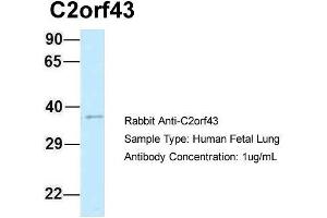 Host: Rabbit  Target Name: C2orf43  Sample Tissue: Human Fetal Lung  Antibody Dilution: 1. (LDAH/C2orf43 抗体  (C-Term))
