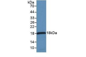 Detection of Recombinant MCP1, Rabbit using Monoclonal Antibody to Monocyte Chemotactic Protein 1 (MCP1) (CCL2 抗体  (AA 24-125))