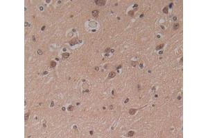 Used in DAB staining on fromalin fixed paraffin- embedded Kidney tissue (IP6K1 抗体  (AA 1-300))