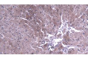 Detection of TEC in Human Liver Tissue using Polyclonal Antibody to Tec Protein Tyrosine Kinase (TEC) (Tec Protein Tyrosine Kinase (TEC) (AA 370-623) 抗体)