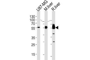 Western Blotting (WB) image for anti-3-Hydroxy-3-Methylglutaryl-CoA Synthase 1 (Soluble) (HMGCS1) antibody (ABIN3002732) (HMGCS1 抗体)