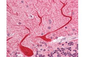 Human Brain, Cerebellum: Formalin-Fixed, Paraffin-Embedded (FFPE). (Enkephalin 抗体  (AA 143-192))