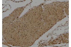 ABIN6275519 at 1/100 staining Human gastric tissue by IHC-P. (DVL3 抗体)