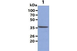 The Cell lysates (40ug) were resolved by SDS-PAGE, transferred to PVDF membrane and probed with anti-human Maspin antibody (1:1000). (SERPINB5 抗体)