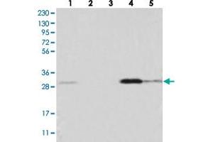 Western blot analysis of Lane 1: RT-4, Lane 2: U-251 MG, Lane 3: Human Plasma, Lane 4: Liver, Lane 5: Tonsil with WDR33 polyclonal antibody . (WDR33 抗体)