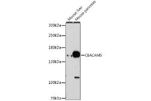 Western blot analysis of extracts of various cell lines, using CEACAM5 antibody. (CEACAM5 抗体)