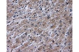 Immunohistochemical staining of paraffin-embedded liver tissue using anti-KIAA1609 mouse monoclonal antibody. (KIAA1609 抗体)
