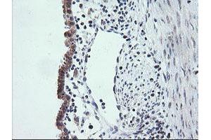 Image no. 2 for anti-V-Ets Erythroblastosis Virus E26 Oncogene Homolog 2 (ETS2) (AA 90-349) antibody (ABIN1491702) (ETS2 抗体  (AA 90-349))