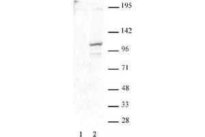 STAT2 phospho Tyr689 pAb tested by Western blot. (STAT2 抗体  (pTyr689))