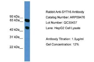 WB Suggested Anti-SYT16  Antibody Titration: 0. (SYT16 抗体  (N-Term))