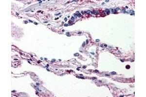 Immunohistochemistry (IHC) image for anti-Complement Component 5a Receptor 1 (C5AR1) antibody (ABIN2470782) (C5AR1 抗体)