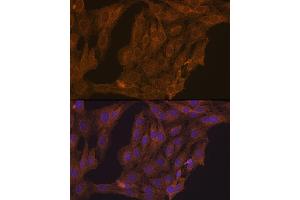 Immunofluorescence (IF) image for anti-Retinoic Acid Receptor, alpha (RARA) (AA 1-457) antibody (ABIN6146692)