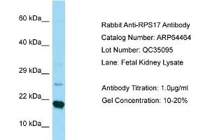 Western Blotting (WB) image for anti-Ribosomal Protein S17 (RPS17) (C-Term) antibody (ABIN2789846) (RPS17 抗体  (C-Term))