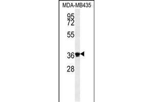 Western blot analysis in MDA-MB435 cell line lysates (35ug/lane). (EXO5 抗体  (AA 166-193))