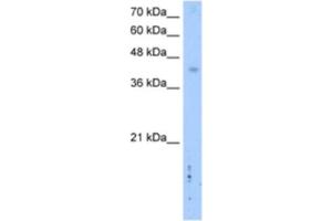 Western Blotting (WB) image for anti-Leucine Rich Repeat Containing 2 (LRRC2) antibody (ABIN2462610) (LRRC2 抗体)