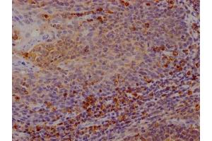 Immunohistochemistry (IHC) image for anti-Cytotoxic T-Lymphocyte-Associated Protein 4 (CTLA4) antibody (ABIN7127437)
