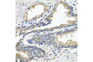 Immunohistochemistry of paraffin-embedded human prostate using ETFA antibody (ABIN5975750) at dilution of 1/100 (40x lens). (ETFA 抗体)