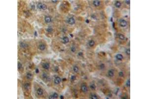 Used in DAB staining on fromalin fixed paraffin-embedded Liver tissue (APOH 抗体  (AA 22-345))