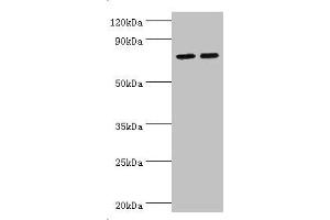 Western blot All lanes: Arachidonate 15-lipoxygenase B antibody at 11 μg/mL Lane 1: MCF-7 whole cell lysate Lane 2: 293T whole cell lysate Secondary Goat polyclonal to rabbit IgG at 1/10000 dilution Predicted band size: 76, 68, 70, 73 kDa Observed band size: 76 kDa (ALOX15B 抗体  (AA 1-200))