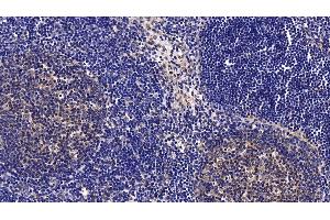 Detection of CD40L in Porcine Lymph node Tissue using Polyclonal Antibody to Cluster Of Differentiation 40 Ligand (CD40L)