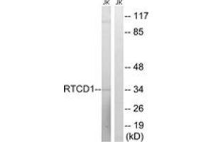 Western blot analysis of extracts from Jurkat cells, using RTCD1 Antibody. (RTCD1 抗体  (AA 317-366))