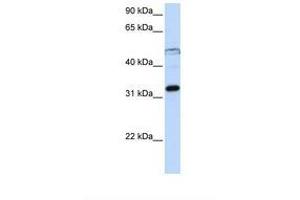 Image no. 1 for anti-Eukaryotic Translation Initiation Factor 3, Subunit G (EIF3G) (AA 218-267) antibody (ABIN6737929) (EIF3G 抗体  (AA 218-267))
