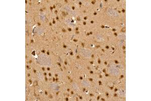 Immunohistochemistry (IHC) image for anti-Calcium/calmodulin-Dependent Protein Kinase IV (CAMK4) (AA 304-473) antibody (ABIN6137891)