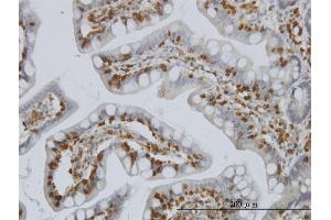 Immunostaining (ISt) image for anti-Phosphatidylinositol-5-Phosphate 4-Kinase, Type II, alpha (PIP4K2A) (AA 304-365) antibody (ABIN562246)