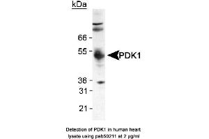 anti-Pyruvate Dehydrogenase Kinase (AA 350-436), (C-Term) antibody