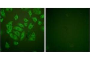 Immunofluorescence analysis of A549 cells, using Stefin A Antibody. (CSTA 抗体  (AA 49-98))