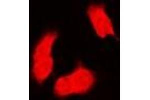 Immunofluorescence (IF) image for anti-Proteasome (Prosome, Macropain) Subunit, beta Type, 9 (Large Multifunctional Peptidase 2) (PSMB9) antibody (ABIN7306016)