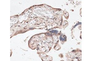 Immunohistochemistry of paraffin-embedded Human placenta using SPDEF Polyclonal Antibody at dilution of 1:100 (40x lens). (SPDEF/PSE 抗体)